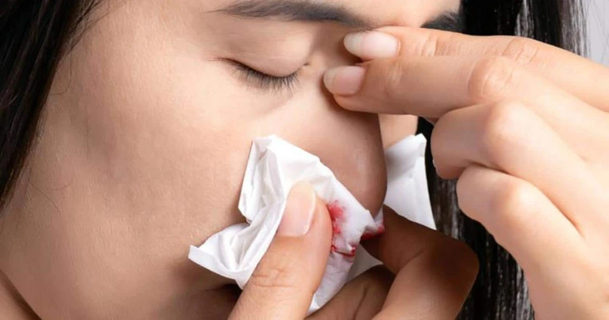 how-to-stop-nose-bleeding