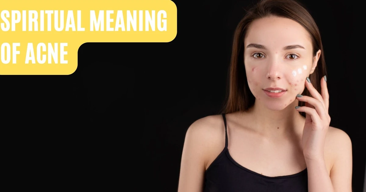 Spiritual Meaning Of Acne Connecting The Mind And Body