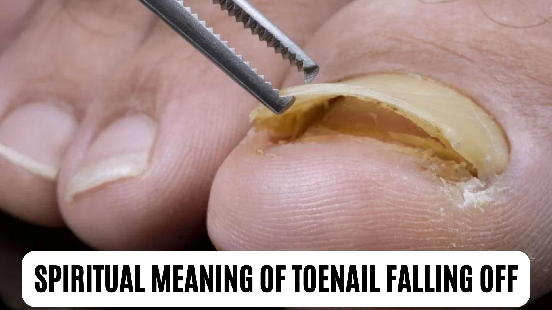 spiritual-meaning-of-toenail-falling-off-a-sign-of-a-major-life-change